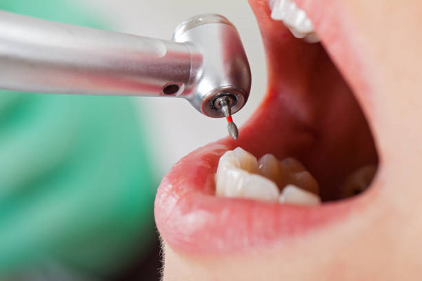 Best After-Hours Dental Trauma Care in Jersey Village, TX